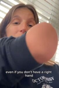 A screencap from a video showing a woman with a missing right forearm, raising her arm for the camera. She is indoors, with window blinds behind her. Text overlay reads: 'even if you don't have a right hand.'