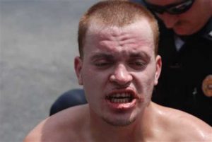 A shirtless man with short hair and a bruised, swollen lip grimaces while a police officer stands behind him. The scene appears to be outdoors in daylight.