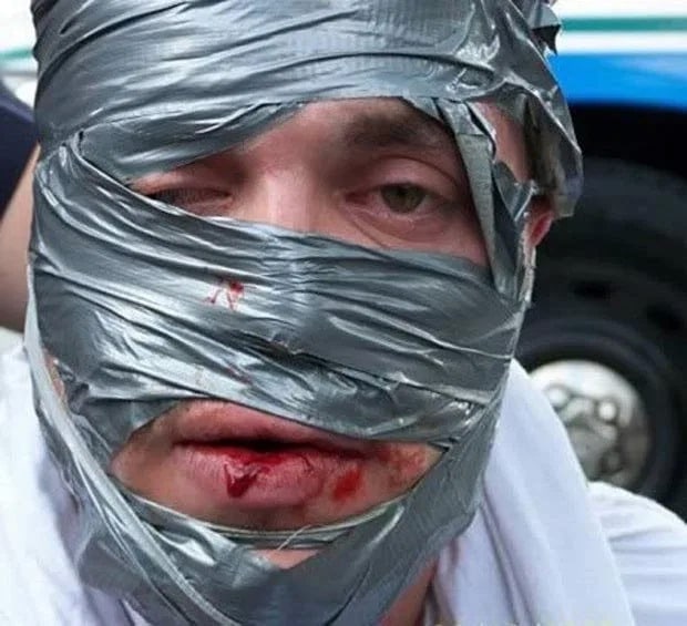 Robber with duct tape on face.
